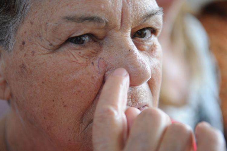 Dia Nacional de Combate ao Câncer de Pele – Fabio Rodrigues Pozzebom/Agência Brasil