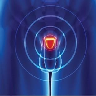 ENTENDA O FUNCIONAMENTO DA PRÓSTATA: ALVO DE PREVENÇÃO DO NOVEMBRO AZUL