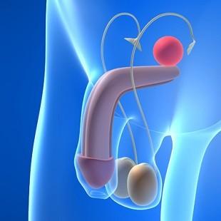 10 Coisas que Você Precisa Saber sobre câncer próstata