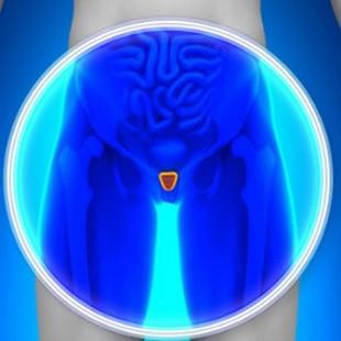 Novembro Azul alerta para prevenção do câncer de próstata